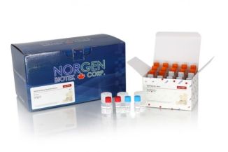 NGS Library Preparation Kits